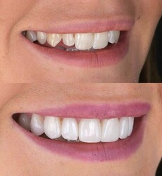 Cosmetic dentist London Marylebone Smile Clinic | Romb