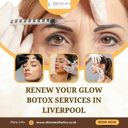 Renew Your Glow Botox Services in Liverpool