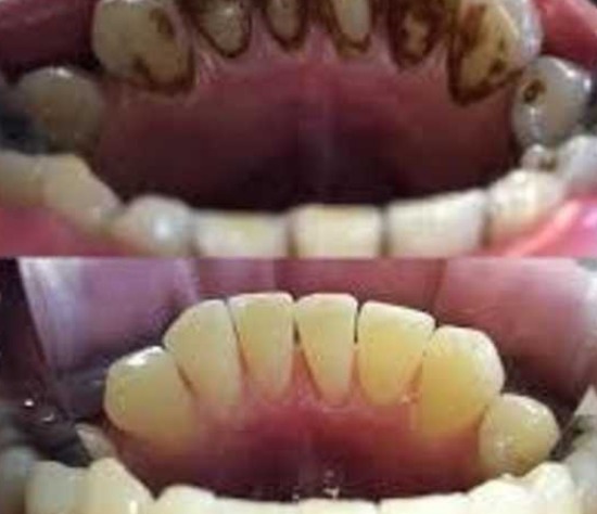 Slough Dental Hygiene  3