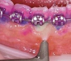 Slough Dental Hygiene thumb-42622
