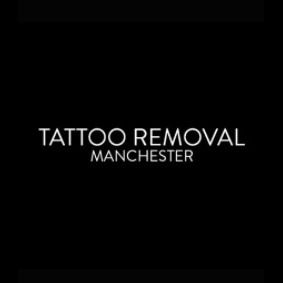 Tattoo Removal Manchester